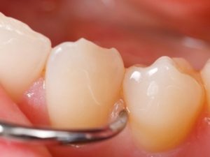 Parodontologia e odontoiatria