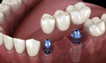 quando-un-impianto-non-ha-senso-milano-e-provincia