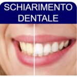 schiarimento-dentale-su-denti-puliti-euro-80-visita-gratuita
